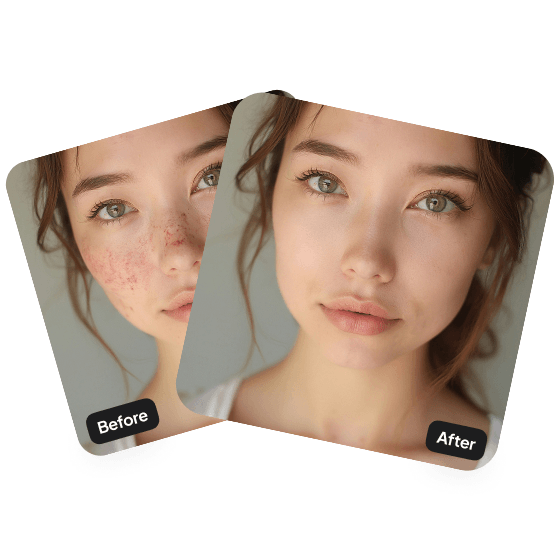 A third sample result from the Blemish Remover, previewing one more edit.